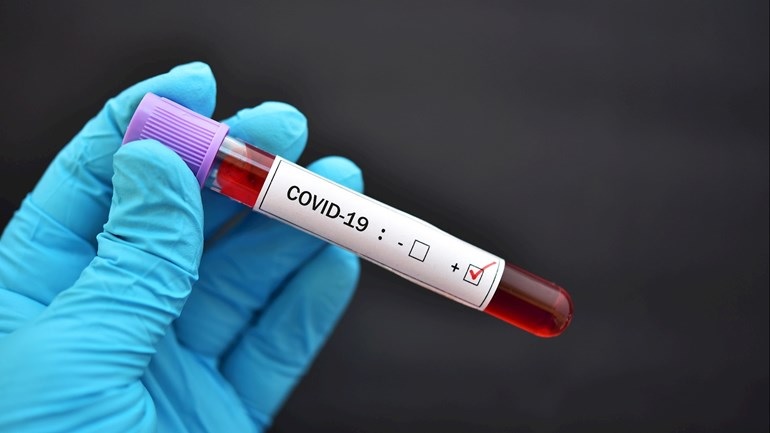 Coronamaatregelen Nationale Politie