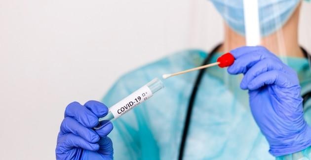 Korps koopt coronatests voor politiemensen